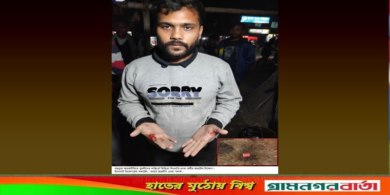 আদমদীঘিতে যুবলীগের মিছিলে ককটেল নিক্ষেপ, ৫ ছাত্রলীগ নেতা আহত আদমদীঘিতে যুবলীগের মিছিলে ককটেল নিক্ষেপ, ৫ ছাত্রলীগ নেতা আহত