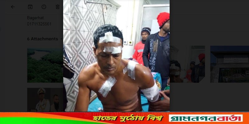 মোরেলগঞ্জে প্রতিপক্ষের হামলায় কৃষক আহত, হাসপাতালে ভর্তি মোরেলগঞ্জে প্রতিপক্ষের হামলায় কৃষক আহত, হাসপাতালে ভর্তি