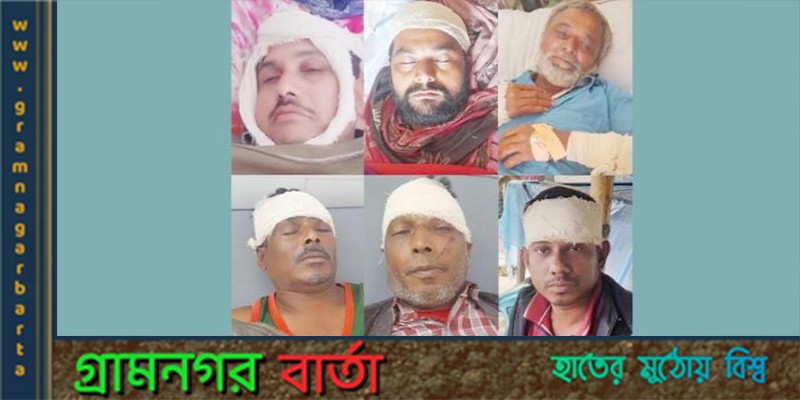বাগেরহাটে আধিপত্য বিস্তার নিয়ে দুই গ্রুপের সংঘর্ষ, আহত ১১ বাগেরহাটে আধিপত্য বিস্তার নিয়ে দুই গ্রুপের সংঘর্ষ, আহত ১১