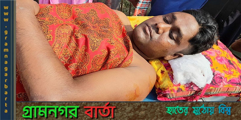 বাগেরহাটে ছাত্রলীগের হামলায় আহত যুবলীগ নেতা বাগেরহাটে ছাত্রলীগের হামলায় আহত যুবলীগ নেতা