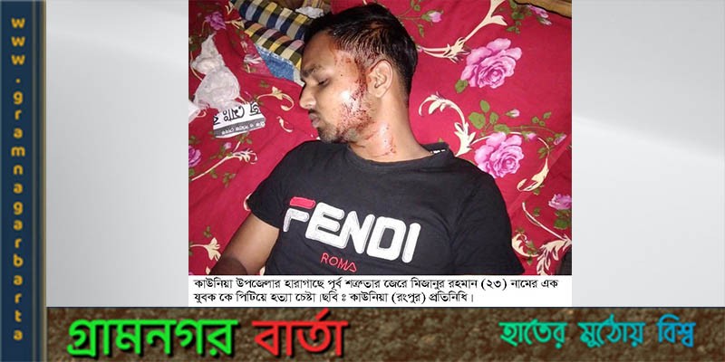 কাউনিয়ায় পূর্ব শত্রুতার জেরে যুবককে পিটিয়ে হত্যার চেষ্টা কাউনিয়ায় পূর্ব শত্রুতার জেরে যুবককে পিটিয়ে হত্যার চেষ্টা