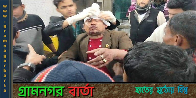 মুন্সীগঞ্জে সন্ত্রাসী হামলায় সংবাদিক আহত মুন্সীগঞ্জে সন্ত্রাসী হামলায় সংবাদিক আহত