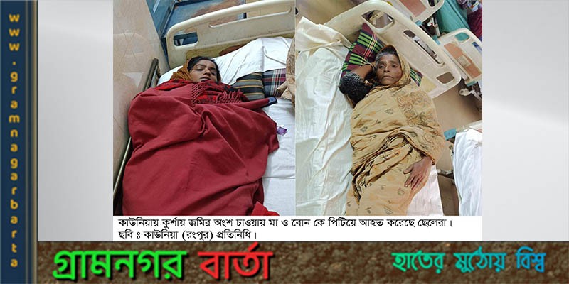 কাউনিয়ায় জমির ভাগ চাওয়ায় মারপিটে মা সহ দুই বোন আহত কাউনিয়ায় জমির ভাগ চাওয়ায় মারপিটে মা সহ দুই বোন আহত