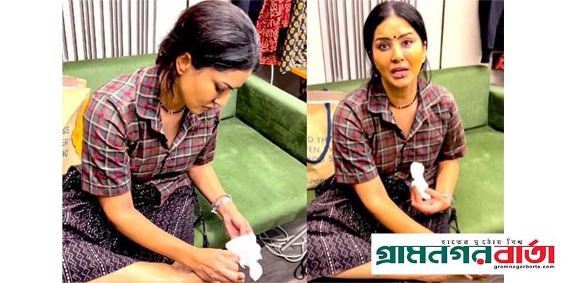 শুটিংয়ের সময় আহত হয়েছেন বলিউড অভিনেত্রী সানি লিওন শুটিংয়ের সময় আহত হয়েছেন বলিউড অভিনেত্রী সানি লিওন