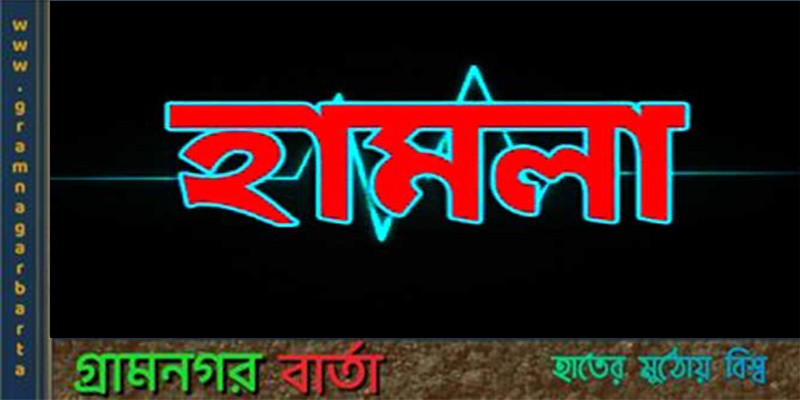 টঙ্গীবাড়িতে জমি নিয়ে বিরোধের জেরে প্রতিপক্ষের হামলায় আহত ৪ টঙ্গীবাড়িতে জমি নিয়ে বিরোধের জেরে প্রতিপক্ষের হামলায় আহত ৪