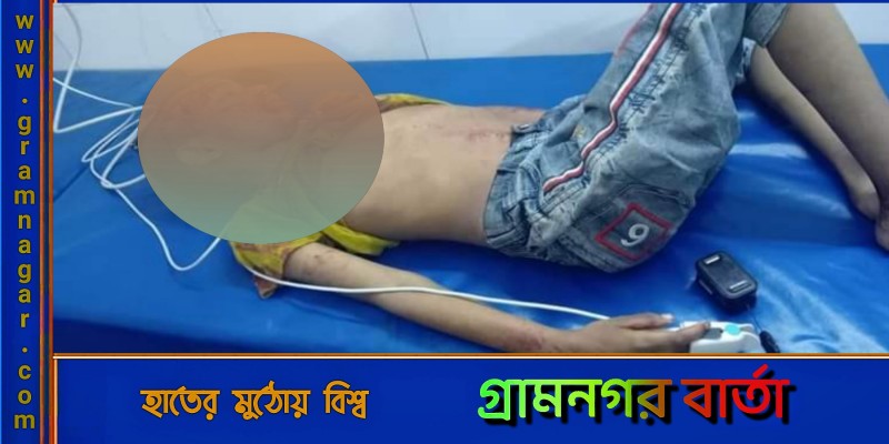 লৌহজংয়ে অটোরিকশা কেড়ে নিল শিশুর প্রাণ লৌহজংয়ে অটোরিকশা কেড়ে নিল শিশুর প্রাণ