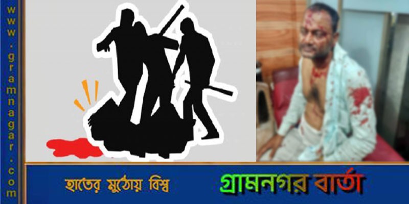 সিরাজদিখানে ব্যবসায়ীকে মারধরকরে ১০লাখ টাকা লুটের অভিযোগ সিরাজদিখানে ব্যবসায়ীকে মারধরকরে ১০লাখ টাকা লুটের অভিযোগ