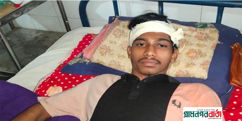 'তুমি' বলে সম্বোধন করায় এক তরুণকে কুপিয়ে জখম 'তুমি' বলে সম্বোধন করায় এক তরুণকে কুপিয়ে জখম