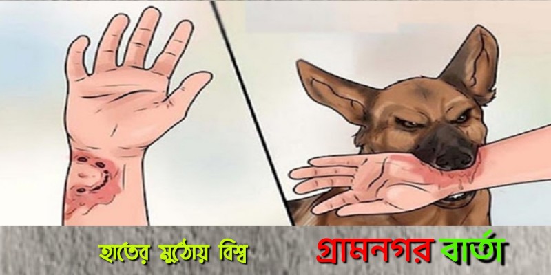 লৌহজংয়ে পাগলা কুকুরের কামড়ে শিশুসহ আহত ৪ লৌহজংয়ে পাগলা কুকুরের কামড়ে শিশুসহ আহত ৪