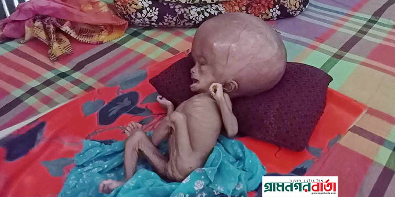 একটি মানবিক আবেদন, অকালে ঝরে না পড়ুক একটি প্রাণ একটি মানবিক আবেদন, অকালে ঝরে না পড়ুক একটি প্রাণ