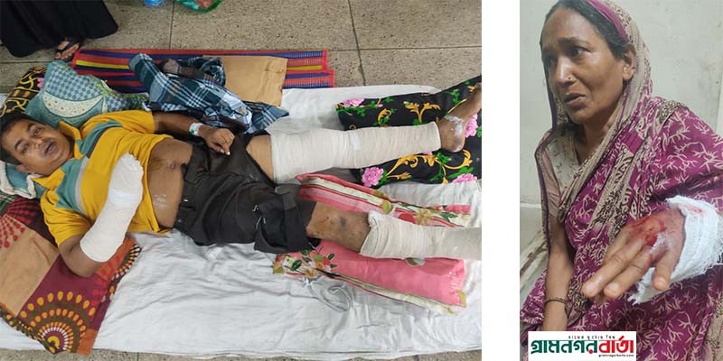 সিরাজদিখানে তুচ্ছ ঘটনায় হামলায় মৃতপ্রায় যুবক সিরাজদিখানে তুচ্ছ ঘটনায় হামলায় মৃতপ্রায় যুবক