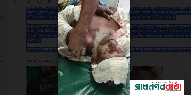 টঙ্গীবাড়িতে একই পরিবারের ৫ জনকে কুপিয়ে জখম টঙ্গীবাড়িতে একই পরিবারের ৫ জনকে কুপিয়ে জখম