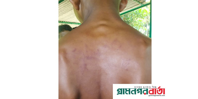 আদমদীঘিতে ট্রাক হেলপারকে আনসার বাহিনীর নির্যাতন, চার ঘন্টা কর্ম বিরতি আদমদীঘিতে ট্রাক হেলপারকে আনসার বাহিনীর নির্যাতন, চার ঘন্টা কর্ম বিরতি