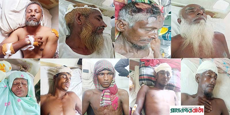 রংপুরে জমি নিয়ে বিরোধ, মহিলা সহ আহত -২৫ রংপুরে জমি নিয়ে বিরোধ, মহিলা সহ আহত -২৫