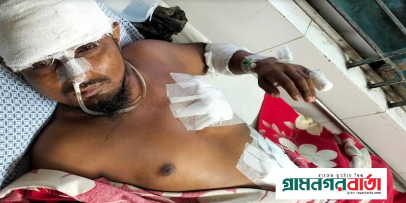 শাজাহানপুরে শ্যালকের ছুরিকাঘাতে মৃত্যুর সাথে পাঞ্জা লড়ছে দুলাভাই শাজাহানপুরে শ্যালকের ছুরিকাঘাতে মৃত্যুর সাথে পাঞ্জা লড়ছে দুলাভাই
