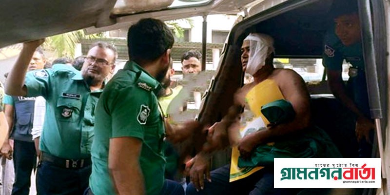 ত্রিমুখী সংঘর্ষে আহত ৪১ পুলিশ হাসপাতালে: ডিএমপি ত্রিমুখী সংঘর্ষে আহত ৪১ পুলিশ হাসপাতালে: ডিএমপি