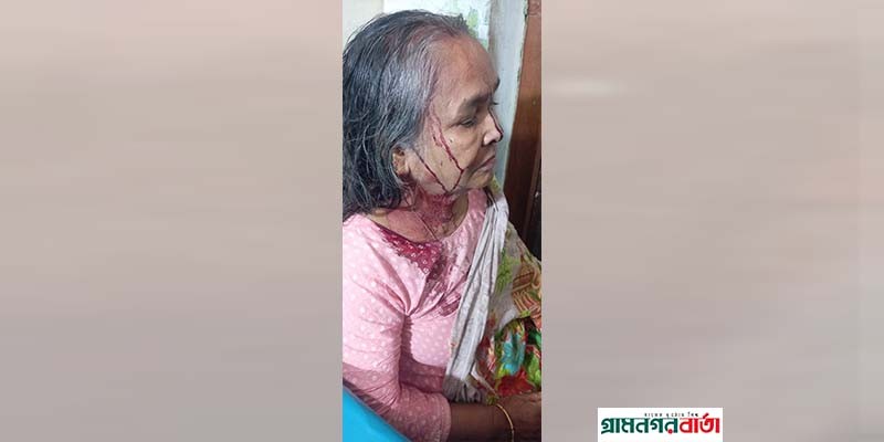 মাদারীপুরে জমি সংক্রান্ত বিরোধের জেরে হামলা, নারীসহ আহত ৩ মাদারীপুরে জমি সংক্রান্ত বিরোধের জেরে হামলা, নারীসহ আহত ৩
