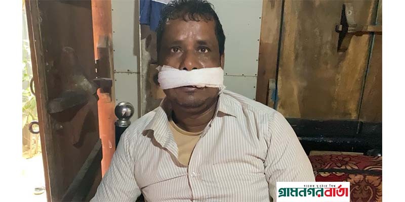 সিরাজদিখানে রাস্তায় গাছ ফেলে ডাকাতির অভিযোগ সিরাজদিখানে রাস্তায় গাছ ফেলে ডাকাতির অভিযোগ