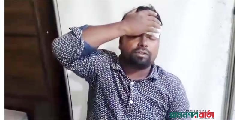 মিয়ানমার থেকে ছোড়া গোলায় বাংলাদেশি আহত মিয়ানমার থেকে ছোড়া গোলায় বাংলাদেশি আহত