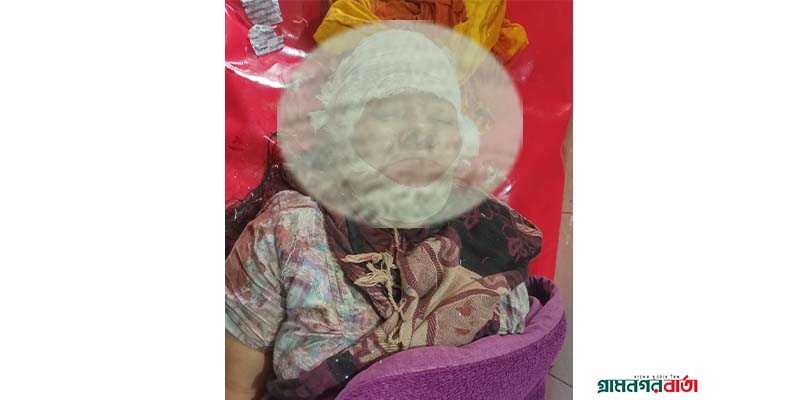 আদমদীঘিতে ভাসুরের ছেলের হাসুয়ার আঘাতে চাচি গুরুতর জখম আদমদীঘিতে ভাসুরের ছেলের হাসুয়ার আঘাতে চাচি গুরুতর জখম
