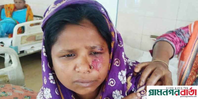 কাউনিয়ায় জামাইয়ের লাঠির আঘাতে শাশুড়ী আহত কাউনিয়ায় জামাইয়ের লাঠির আঘাতে শাশুড়ী আহত