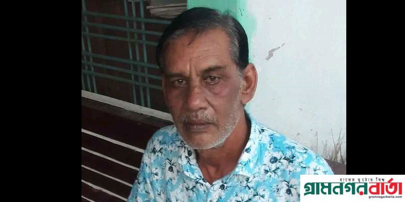 পঞ্চগড়ে যুদ্ধাহত বীর মুক্তিযোদ্ধা জহিরুল ইসলামের ইন্তেকাল পঞ্চগড়ে যুদ্ধাহত বীর মুক্তিযোদ্ধা জহিরুল ইসলামের ইন্তেকাল
