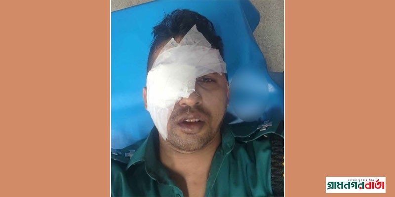 হামলায় এসআইয়ের চোখ নষ্ট : গ্রেপ্তার ৪ হিজড়া হামলায় এসআইয়ের চোখ নষ্ট : গ্রেপ্তার ৪ হিজড়া