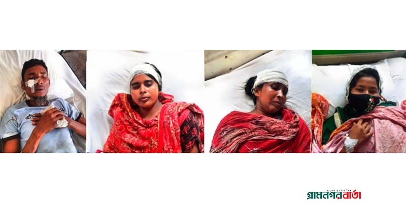 আদমদীঘিতে পুকুরে মাছ ধরা নিয়ে সংঘর্ষে নারীসহ আহত ১০ আদমদীঘিতে পুকুরে মাছ ধরা নিয়ে সংঘর্ষে নারীসহ আহত ১০