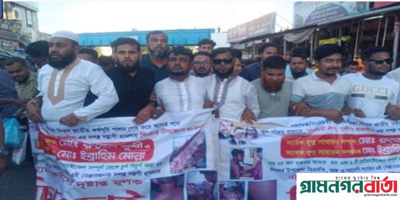 শিবচরে ছাত্রদলের উপর হামলার বিচারের দাবীতে বিক্ষোভ ও মানববন্ধন শিবচরে ছাত্রদলের উপর হামলার বিচারের দাবীতে বিক্ষোভ ও মানববন্ধন