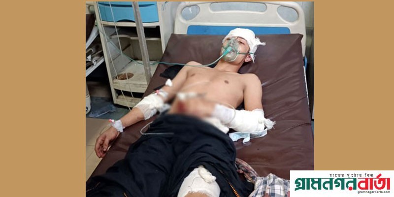 আহত সিলেটের কাউন্সিলর আফতাব হোসেনের ভাতিজার অবস্থা আশঙ্কাজনক আহত সিলেটের কাউন্সিলর আফতাব হোসেনের ভাতিজার অবস্থা আশঙ্কাজনক