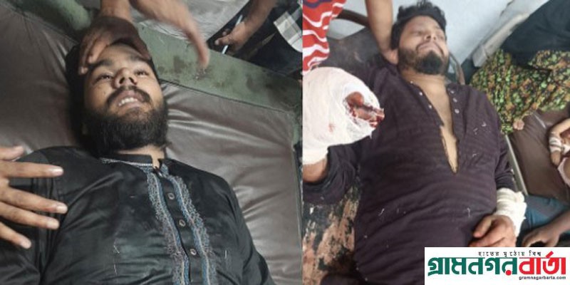 সিলেটে ছাত্রলীগ নেতাকে কুপিয়ে আহত, দুর্বৃত্তরা এখন ধরা ছোঁয়ার বাহিরে সিলেটে ছাত্রলীগ নেতাকে কুপিয়ে আহত, দুর্বৃত্তরা এখন ধরা ছোঁয়ার বাহিরে