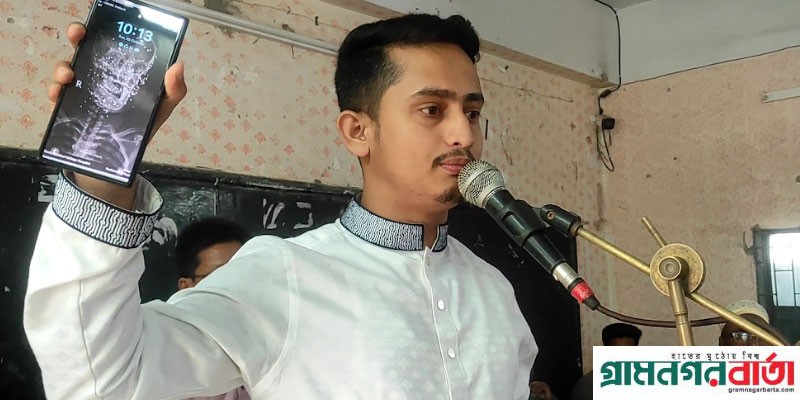 ছাত্র আন্দোলনে ১৮ বছরের হিমেলের মাথায় সাড়ে তিনশত বুলেট লেগেছিল ছাত্র আন্দোলনে ১৮ বছরের হিমেলের মাথায় সাড়ে তিনশত বুলেট লেগেছিল