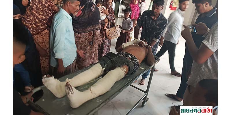 মাদারীপুরে ব্যবসায়ীকে কুপিয়ে জখম মাদারীপুরে ব্যবসায়ীকে কুপিয়ে জখম