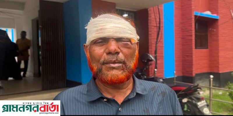 শ্রীনগরে চায়ের দোকানে কথাকাটাকাটির জেরে প্রতিপক্ষের হামলায় আহত-২ শ্রীনগরে চায়ের দোকানে কথাকাটাকাটির জেরে প্রতিপক্ষের হামলায় আহত-২