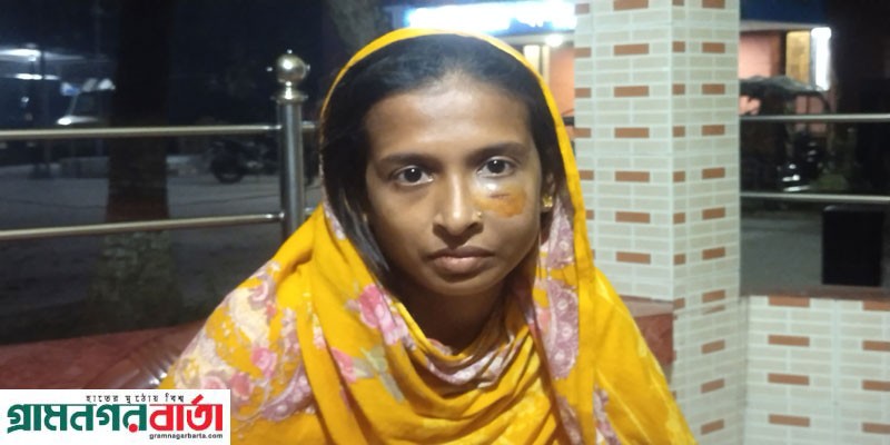 শ্রীনগরে বাচ্চাদের ঝগড়াকে কেন্দ্র করে প্রতিপক্ষের হামলায় নারীসহ আহত-৭ শ্রীনগরে বাচ্চাদের ঝগড়াকে কেন্দ্র করে প্রতিপক্ষের হামলায় নারীসহ আহত-৭