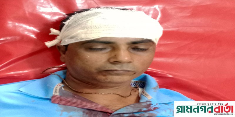 আদমদীঘিতে জমি নিয়ে বিরোধ সাংবাদিকসহ আহত-২ আদমদীঘিতে জমি নিয়ে বিরোধ সাংবাদিকসহ আহত-২