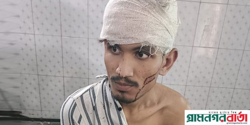 মুন্সীগঞ্জ পলিটেকনিক ইনস্টিটিউটে ছাত্রলীগ ও সাধারণ শিক্ষার্থীদের মধ্যে সংঘর্ষ আহত -১০ মুন্সীগঞ্জ পলিটেকনিক ইনস্টিটিউটে ছাত্রলীগ ও সাধারণ শিক্ষার্থীদের মধ্যে সংঘর্ষ আহত -১০