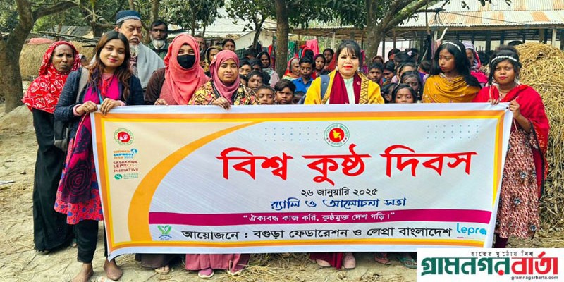 নন্দীগ্রামে নানা আয়োজনে বিশ্ব কুষ্ঠ দিবস পালিত নন্দীগ্রামে নানা আয়োজনে বিশ্ব কুষ্ঠ দিবস পালিত