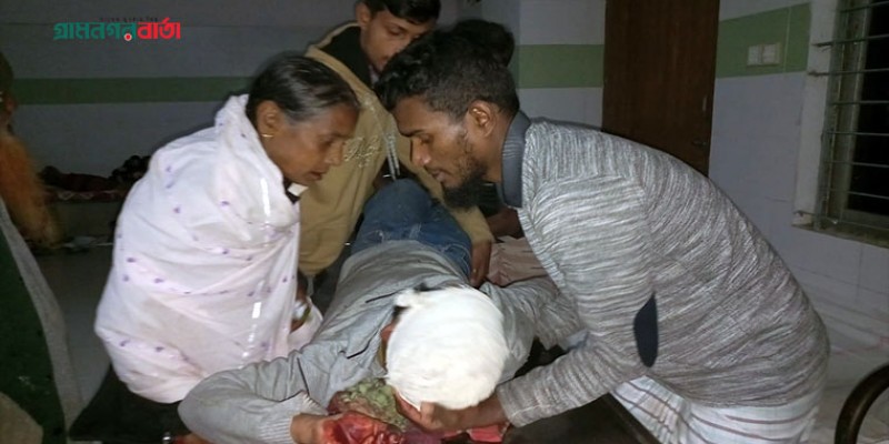বরগুনায় মাদক সেবী কর্তৃক কুপিয়ে জখম করা ব্যক্তির অবস্থা আশংকাজনক বরগুনায় মাদক সেবী কর্তৃক কুপিয়ে জখম করা ব্যক্তির অবস্থা আশংকাজনক