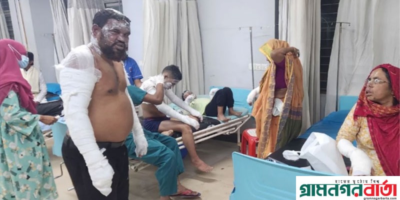 আশুলিয়ায় গ্যাস সিলিন্ডার বিস্ফোরণ: ৪ শিশুসহ দগ্ধ ১১ আশুলিয়ায় গ্যাস সিলিন্ডার বিস্ফোরণ: ৪ শিশুসহ দগ্ধ ১১