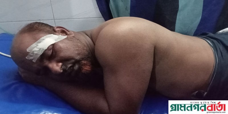 শিবগঞ্জে নাগরিক ঐক্যর আহবায়ক শহিদ মিনারে ফুল দিতে গিয়ে দুর্বৃতদের হামলার শিকার শিবগঞ্জে নাগরিক ঐক্যর আহবায়ক শহিদ মিনারে ফুল দিতে গিয়ে দুর্বৃতদের হামলার শিকার