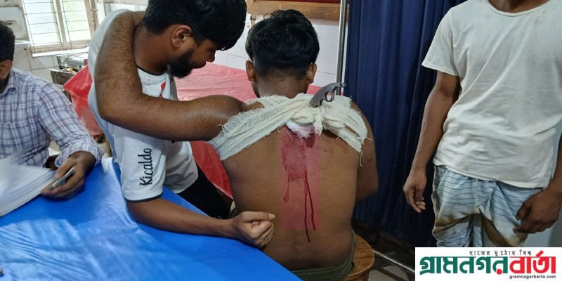 শ্রীনগরে মাদক সেবনে বাধা দেয়ায় সুইচগিয়ারের আঘাতে যুবক গুরুত্বর আহত শ্রীনগরে মাদক সেবনে বাধা দেয়ায় সুইচগিয়ারের আঘাতে যুবক গুরুত্বর আহত