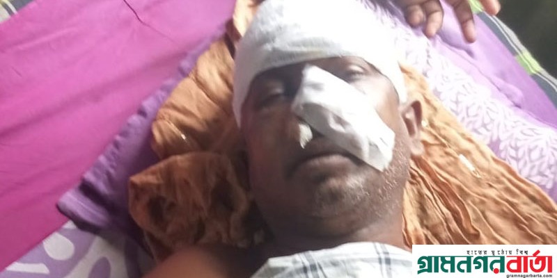 শ্রীনগরে ফল বিক্রেতাকে কুপিয়ে টাকা ছিনতাই শ্রীনগরে ফল বিক্রেতাকে কুপিয়ে টাকা ছিনতাই