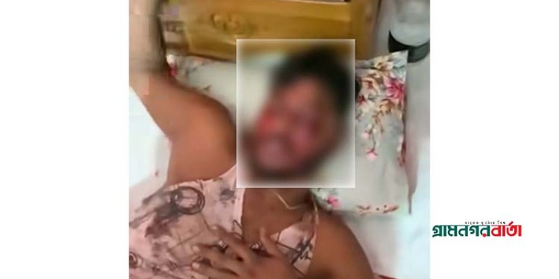 শ্রীনগরে সন্ত্রাসী রাসেলের দুই চোখ উপড়ে ফেলেছে প্রতিপক্ষ শ্রীনগরে সন্ত্রাসী রাসেলের দুই চোখ উপড়ে ফেলেছে প্রতিপক্ষ