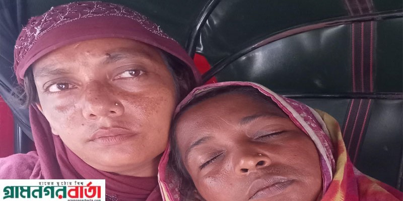 শিবগঞ্জে জমিজমা বিরোধের জেরে নারীকে পিটিয়ে আহত করার অভিযোগ 