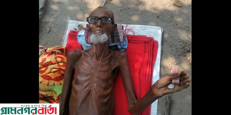 সময়ের পরিবর্তনে আদমদীঘির বাবলু আজ রাস্তা'র ভিক্ষুক সময়ের পরিবর্তনে আদমদীঘির বাবলু আজ রাস্তা'র ভিক্ষুক