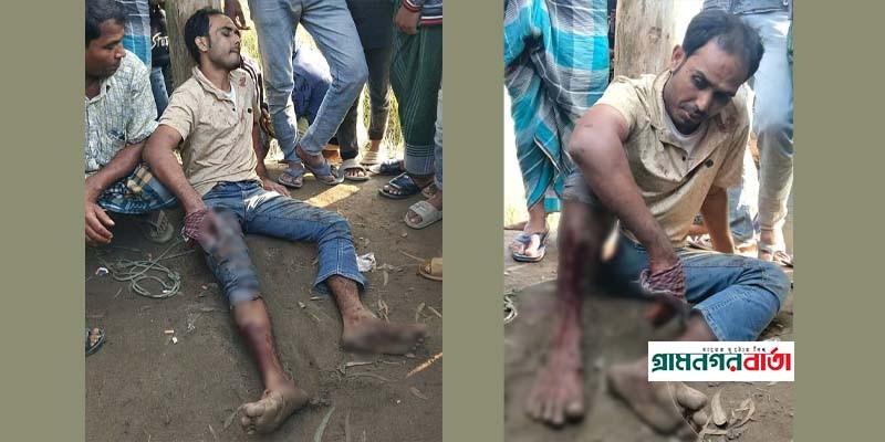 পঞ্চগড়ে চোর সন্দেহে যুবদল নেতাকে মারপিট, ভেঙ্গে গেছে পা