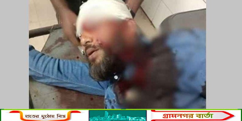 এবার খুলনায় এনসিপি নেতার মাথায় গুলি, অবস্থা আশঙ্কাজনক