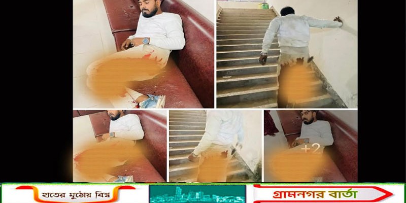 নন্দীগ্রামে কলেজ ছাত্রদলের সভাপতিকে ছুরিকাঘাত