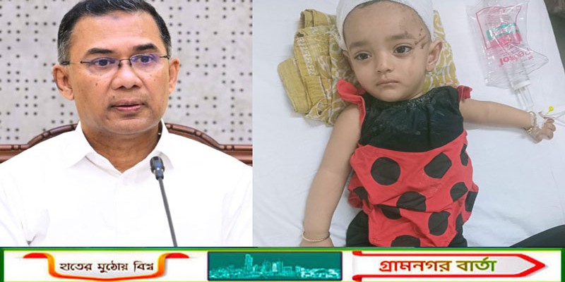 বগুড়ায় সড়ক দুর্ঘটনায় বেঁচে যাওয়া সেই শিশুর চিকিৎসার দায়িত্ব নিলেন প্রধানমন্ত্রী